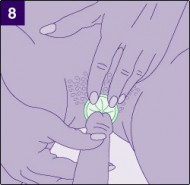 презерватив для женщин