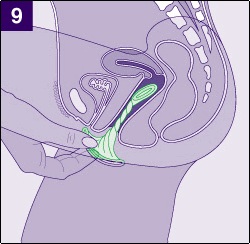 фото женский презерватив фото женский презерватив